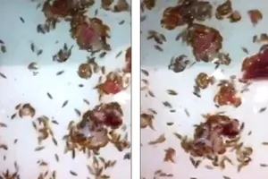 Chân bê bết máu vì rệp biển ăn thịt người