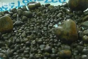 Mê ăn thịt mỡ, bà cụ có 806 viên sỏi mật