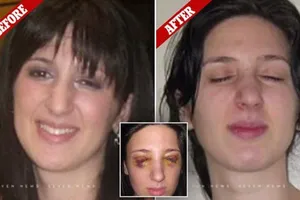 Cô gái với đôi mắt 3 ngày đóng, 3 ngày mở