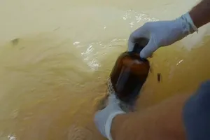 Bà cụ Mỹ chết vì vi khuẩn ăn thịt người sau bão Harvey