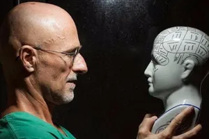 Đã sẵn sàng để ghép đầu người đầu tiên trên thế giới