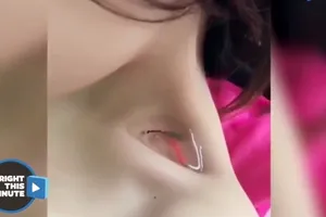 Choáng với trào lưu nuôi cá trong hõm xương quai xanh