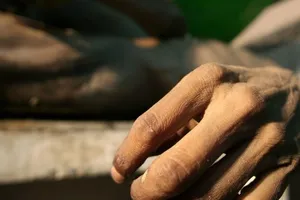 Phát hiện 4 xác ướp bí ẩn tại bệnh viện BV Moscow