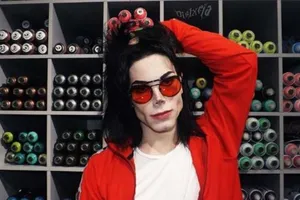 15 tuổi trải qua 11 ca phẫu thuật để giống Michael Jackson