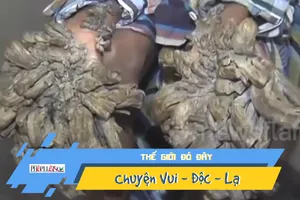 Căn bệnh 'người cây' khủng khiếp đeo bám chàng trai trẻ