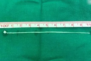 Kinh dị giun dài 10 cm sống trong não người đàn ông 30 năm 