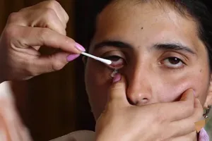 Kỳ lạ cô gái mỗi ngày khóc ra 50 viên thủy tinh