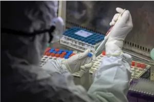Bộ dụng cụ chẩn đoán virus COVID-19 được phát triển tại một phòng thí nghiệm ở Quảng Đông, Trung Quốc, tỉnh bị ảnh hưởng nặng thứ hai trong vụ dịch. Ảnh: EPA-EFE