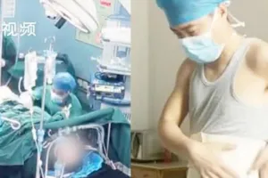 Bác sĩ Lu Yan bị ngã khi đang làm phẫu thuật. Ảnh: SHANGHAIIST