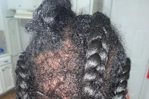 Một bím tóc của Wallace bị nhóm thực khách nhổ trụi. Ảnh: TWITTER/SPUTNIK