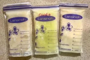 Sữa mẹ bỗng chuyển màu xanh lá sau khi mẹ nhiễm COVID-19