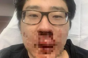 Giảng viên Trung Quốc bị tấn công vô lý ở Anh