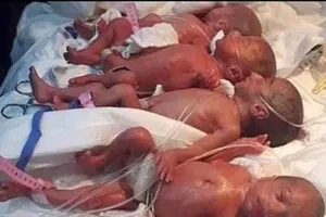 Một sản phụ sinh một lúc 9 người con
