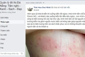 Dân Đà Nẵng lo lắng khi cứ tắm biển là ngứa