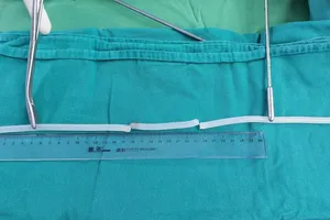 Người đàn ông nhét keo nến vào niệu đạo để tạo khoái cảm