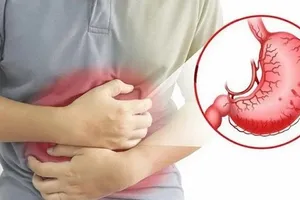 Nam sinh 15 tuổi thủng dạ dày do thói quen rất nhiều người mắc phải