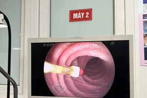 Kim diệt tủy răng lọt vào ruột non bé 8 tuổi