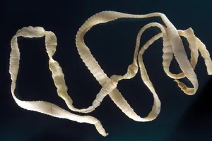 Sán dây dài 10 mét "ẩn" trong người đàn ông