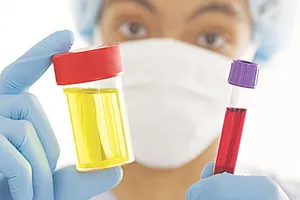 Đi tiểu ra máu cảnh báo bệnh gì?