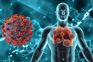 90% ung thư phổi xuất phát từ thói quen này