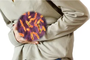 Cần làm gì để hạn chế nhiễm khuẩn Salmonella? 