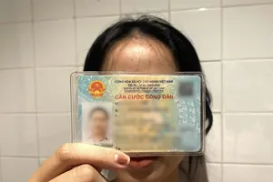 Sau phẫu thuật thẩm mỹ, có cần đổi lại CCCD không?