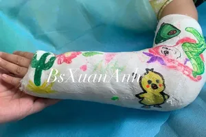 Biến nỗi đau bó bột thành tác phẩm nghệ thuật