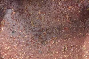 Kinh hãi giòi lúc nhúc trong tương ớt