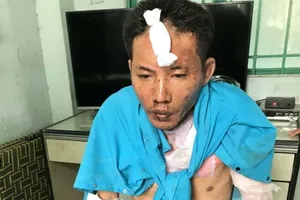 Khủng khiếp chồng hờ đổ xăng đốt vợ và 2 con nhỏ