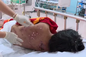 Bắt thêm 3 người tra tấn dã man cô gái bán cà phê