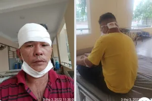 Đi thanh toán tiền lương bị người của công ty bảo vệ đánh hội đồng