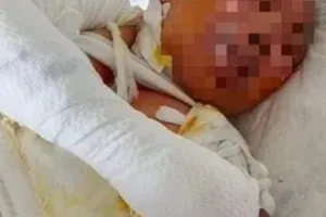 Một phụ nữ bị tạt xăng đốt cháy ở Đồng Nai