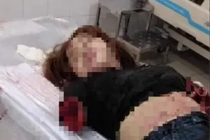 Đồng Nai: Khởi tố người chồng chém đứt lìa 2 cánh tay của vợ