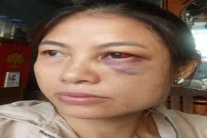 Công an điều tra vụ 1 phụ nữ cầu cứu vì liên tục bị chồng bạo hành