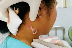 Sức khỏe bé gái 14 tuổi bị nhiễm vi khuẩn 'ăn thịt người' ở Đồng Nai