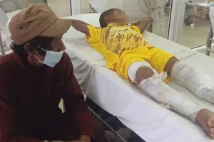 Công an thông tin vụ bé trai 8 tuổi ở Đắk Lắk bị bỏng 2 chân