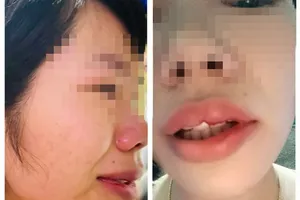 Vụ cô giáo bị phụ huynh đánh: Tỉnh Đắk Nông yêu cầu công an vào cuộc