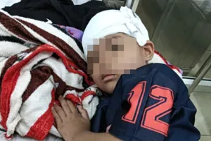 Truy tìm 1 phụ nữ chạy xe máy tông cháu bé 5 tuổi bất tỉnh ở Đắk Lắk