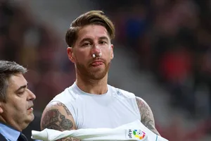 Derby quá tổn hại, Real Madrid mang đội hình què quặt đến Nga