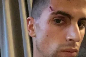 Hậu vệ của Man City bị trộm ghé thăm