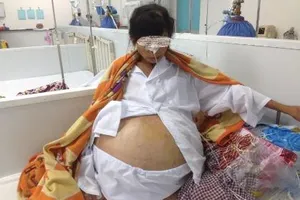 Mổ lấy khối u 12 kg trong bụng nữ bệnh nhân