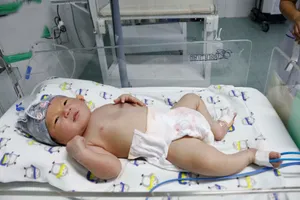 Cứu sống bé sơ sinh bệnh não thiếu oxy, thiếu máu não