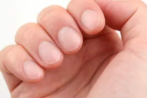 Nhìn móng tay, đoán sức khỏe