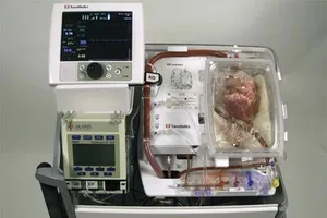 Lần đầu tiên cấy ghép tim "chết" cho người sống