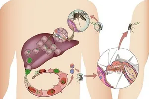 Sốt rét đang trở lại châu Á
