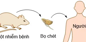 Triệu chứng bệnh dịch hạch và phòng ngừa