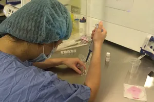 Vì sao thụ tinh ống nghiệm dễ sinh đa thai?