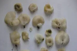 Hơn 10 người nhập viện cấp cứu vì ngộ độc nấm 