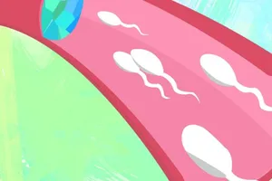 Loại gel mới giúp tránh thai dành cho nam giới