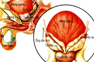 Bệnh tuyến tiền liệt – chớ coi thường